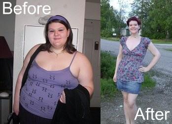 before-after